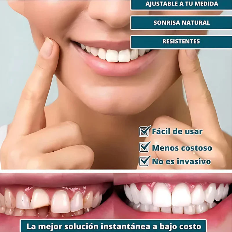 [PROMO] SmilePro 🦷 - Carillas Dentales Ajustables De Resina + ESTUCHE REGALO - ¡Últimas unidades! 🔥