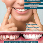 [PROMO] SmilePro 🦷 - Carillas Dentales Ajustables De Resina + ESTUCHE REGALO - ¡Últimas unidades! 🔥