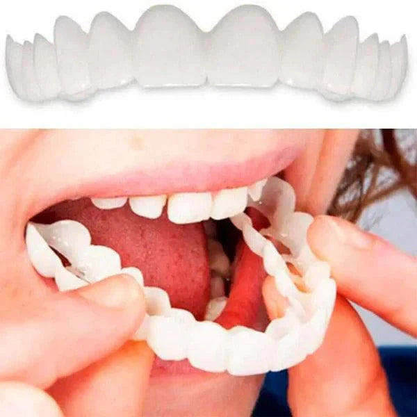 [PROMO] SmilePro 🦷 - Carillas Dentales Ajustables De Resina + ESTUCHE REGALO - ¡Últimas unidades! 🔥