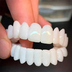 [PROMO] SmilePro 🦷 - Carillas Dentales Ajustables De Resina + ESTUCHE REGALO - ¡Últimas unidades! 🔥