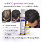 Duo Anticaida Capilar Shampoo + Tonico